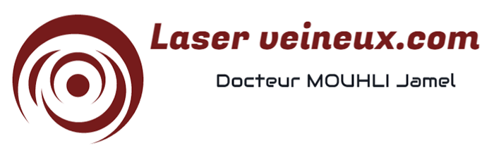 Principe : le laser agit par action thermique en trois étapes successives : du collagène .Différentes longueurs d’onde sont utilisées : conversion de la lumière en chaleur qui varie en fonction du milieu dans lequel la lumière est délivrée et de la longueur d’onde émise, transfert de chaleur par conduction dans les tissus de la paroi veineuse, puis destruction thermochimique 810, 940, 980, 1064, 1319 et 1470 nanomètres.
